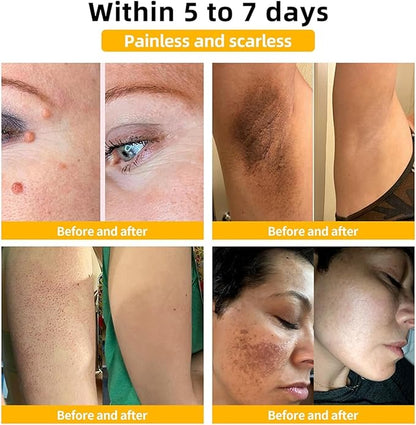 Bee Venom Skin Treatment Cream,Repair Maximum Strength for All Skin Types (2PCS)